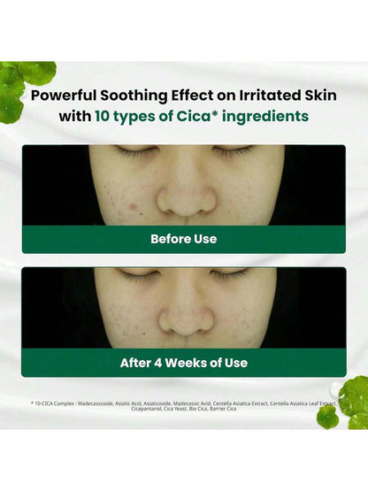 Dr.G Red Blemish Clear Soothing Cica Cream 70 ml – gel‑cream moisturizer

Calming cica cream for redness-prone skin

Soothing niacinamide and centella gel moisturizer

Lightweight hydration cream for sensitive blemish-prone skin

Barrier-restoring cica moisturizer for acne calm